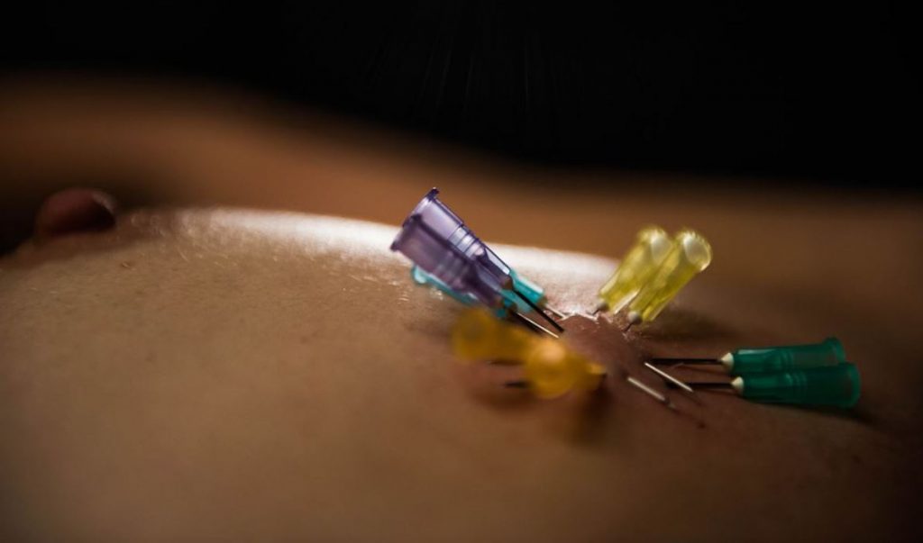 fetcetera | Learn to play: Needle Play